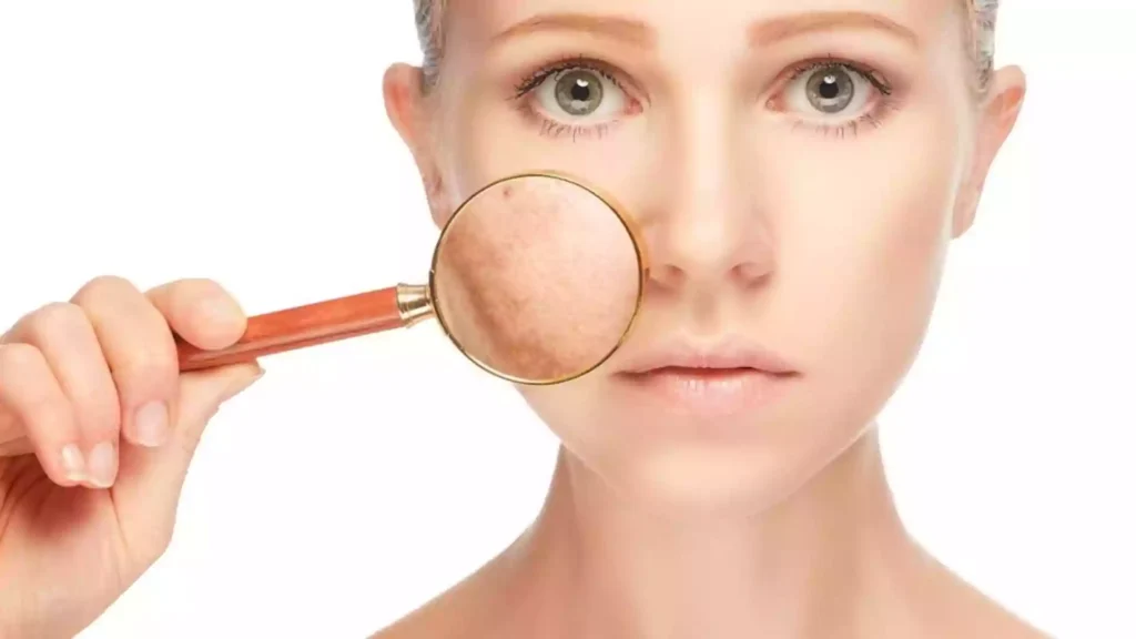 Cómo eliminar Manchas del Rostro usando el Vigor Solar 3 manchas en la piel vigor solar vigorosamente 02