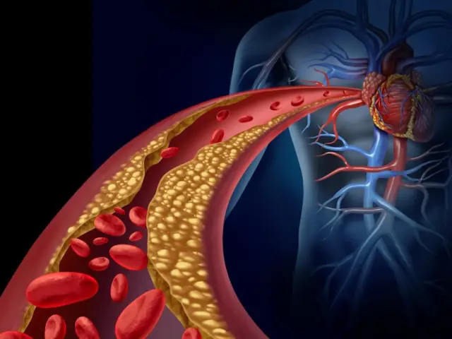 ginseng siberiano disfuncion erectil