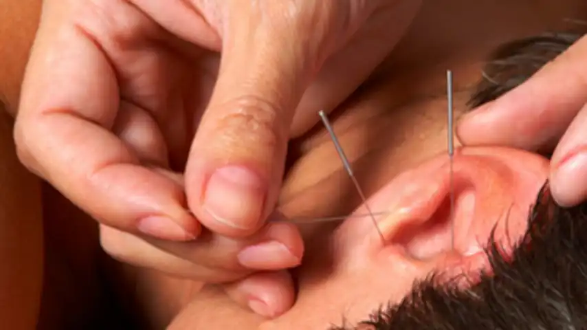 auriculoterapia vigorosamente 16