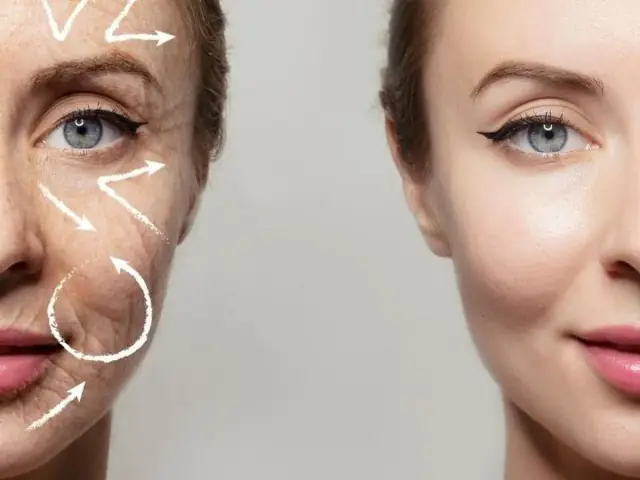 Colágeno Hidrolizado Con Zinc, Biotina y Vitamina C 5 Colageno vigorosamente 03