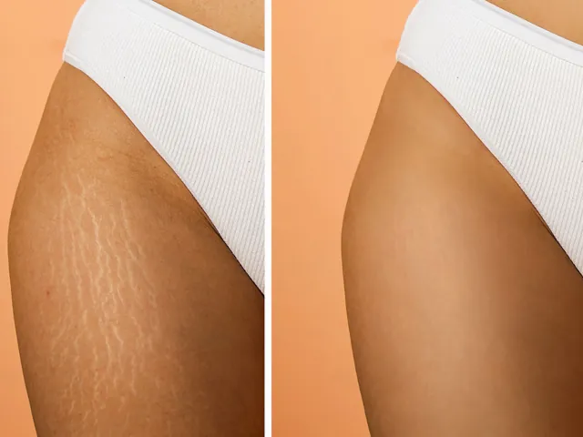 Centella Asiatica 04