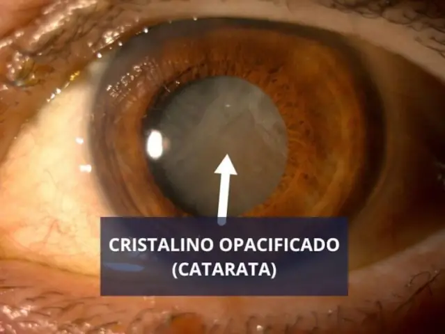 centrum-silver-protege-tu-vista-05 centrum silver cuidado de la vista