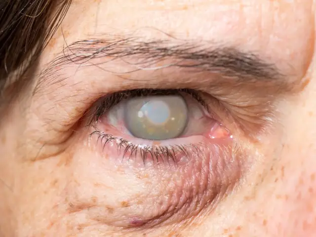 centrum-silver-protege-tu-vista-07 centrum silver cuidado de la vista