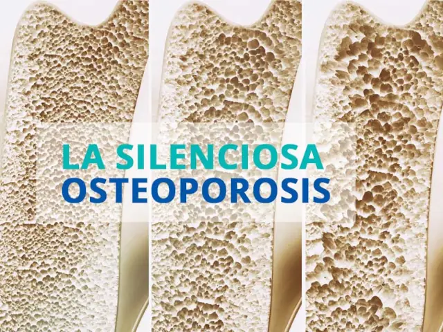 centrum-silver-salud-osea-3 centrum silver salud osea